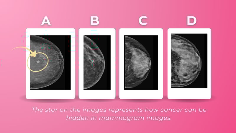 dense breast categories